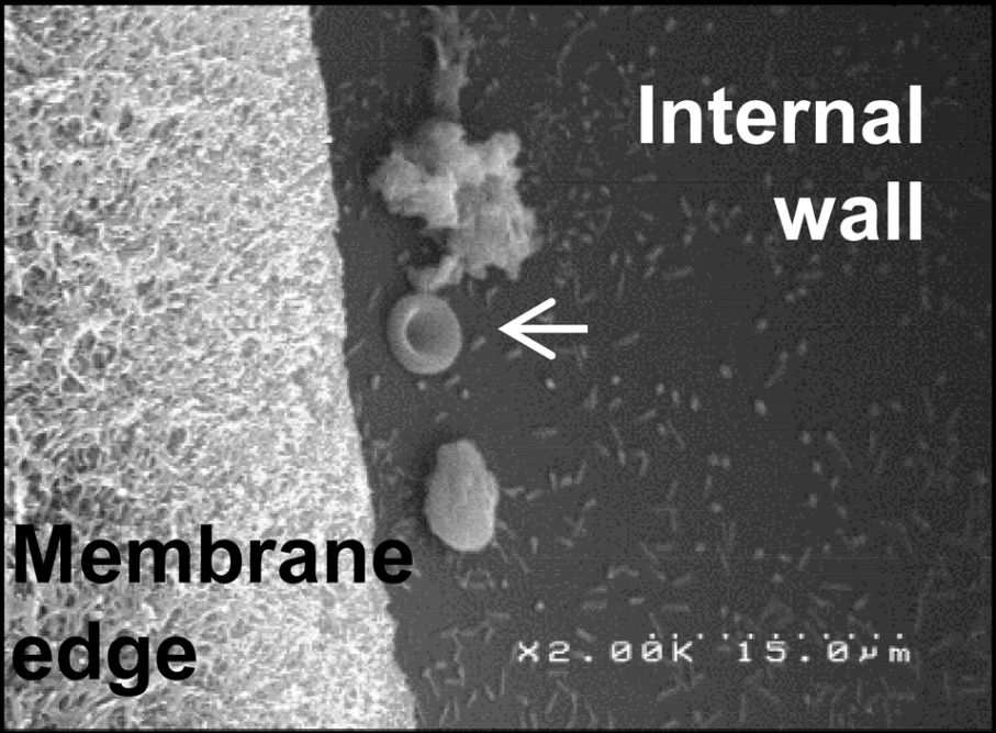 Membrane micro RDN-cut